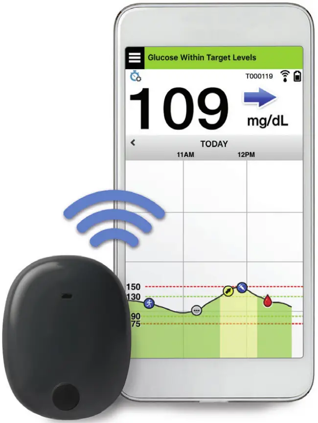 eversense XL Continuous Glucose Monitoring System