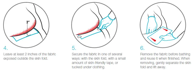 Coloplast-M5105N Interdry-Moisture-Wicking-Fabric-FIG 2