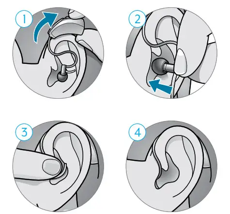 Starkey 19488483997 Receiver In Canal with Earbud - Insertion and Removal