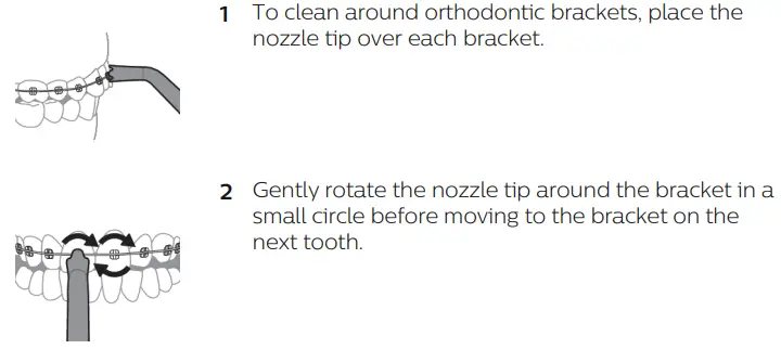 PHILIPS 3000 Series HX3806 Sonicare Cordless Power Flosser User Manual - Cleaning Orthodontic Brackets with the Quad Stream Nozzle