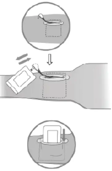 Power Pack Installation