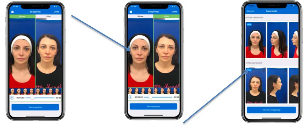 NMREV1-Next-motion-revelation-FIG-11