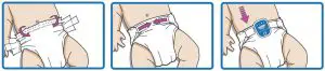 FIG 3 Pico squarely attached to the pants or diaper