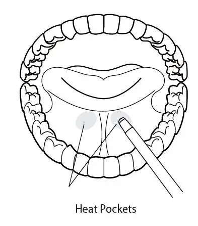 COVIDIEN Filac 3000 EZ EZA Electronic Thermometer fig6