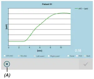 NIOX 002346 05 Vero Nasal Measurement Mode - FIGURE 30