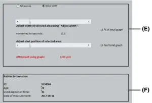NIOX 002346 05 Vero Nasal Measurement Mode - FIGURE 33