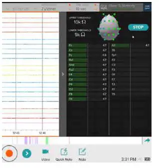 lifelines neuro Trackit M Portable EEG System-11