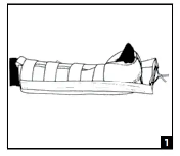 DJO Procare-BUCKS TRACTION SPLINT-1