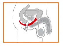 Kegel8 82217 V For Men Pelvic Toner fig 5