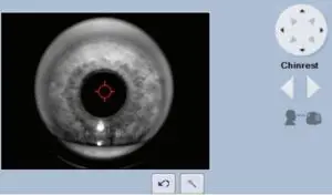 Find the pupil and focus the image in the iris viewport