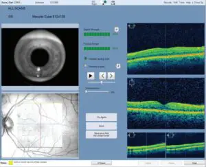 Review the captured scan, then save or try again.