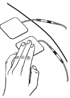 INTENSITY DI1010 Digital Tens-FIG7