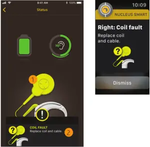 Cochlear Addendum to Nucleus Smart App for iPhone and iPod touch - Status screen 2