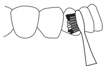 TORPYU-Oral-Irrigator-Electric-Toothbrush-with-Water-Flosser-FIG-25