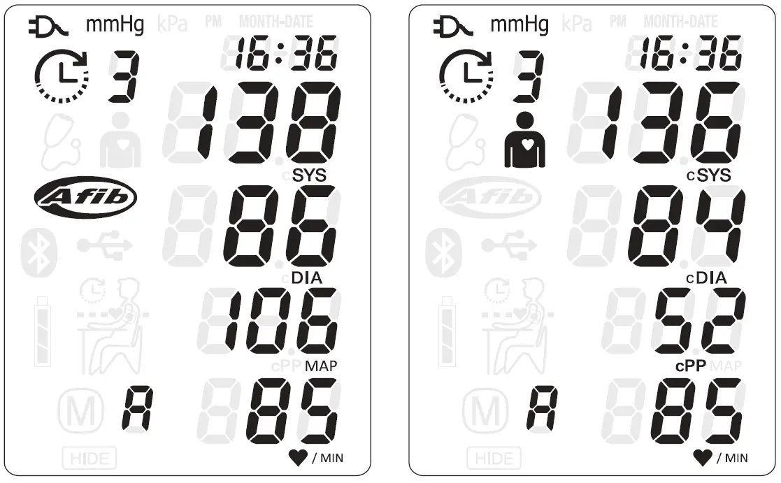 MICROLIFE BP 3SK1-3B Professional Automated Office Blood Pressure Monitor 15