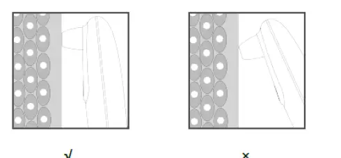 Shenzhen-Dianzhui-Culture-Technology-DZ03-Visual-Blackhead-Vacuum-Device-FIG-6