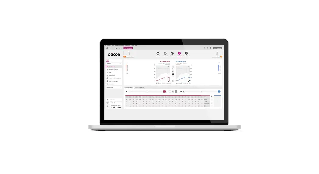 Oticon Audigyfit 2 Agxo E Series Hearing Aid Fitting Software User Guide