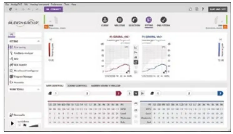 oticon AudigyFit 2 AGXO E Series Hearing Aid Fitting Software-Fitting Screen
