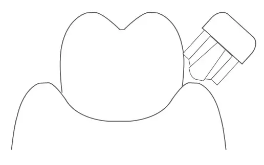 Ulike CB02 Sonic Electric Toothbrush - figure 12