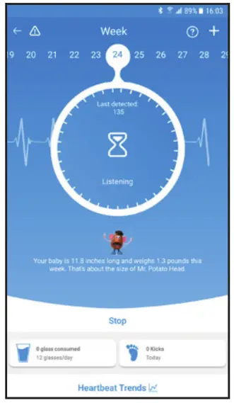 hubble Roo Prenatal Heartbeat Monitor - dynamics