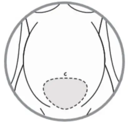 hubble Roo Prenatal Heartbeat Monitor - heartbeat sound