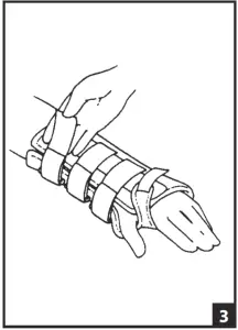 DONJOY 79 87050 Universal Wrist Forearm Support - fig