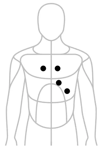 3M 8490 Littmann Core Digital Stethoscope- Placement