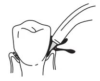 H2ofloss-HF-6-Water-Flosser-Portable-Dental-Oral-Irrigator-fig-7