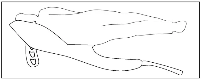 Joerns-Oxford-PHSL-E1A1706-Full-Back-Sling-FIG-4