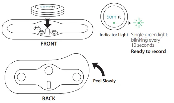 Compumedics-Somfit-Sleep-Signal-Tracker-fig-5