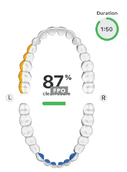 Colgate PLAQLESS PRO Smart Sensing Sonic Toothbrush 3