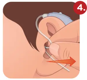 otofonix Apex Hearing Aid for Senior and Adults-Ear4