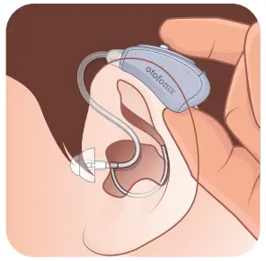 otofonix Apex Hearing Aid for Senior and Adults-Tips