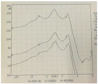 JINGHAO JH 125 Analog BTE RIC Hearing Amplifier - FrequencyRange