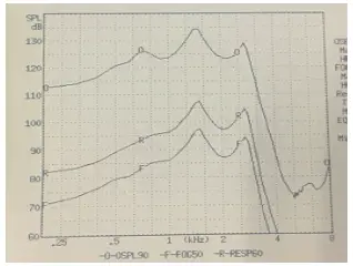 JINGHAO JH 125 Analog BTE RIC Hearing Amplifier - Model