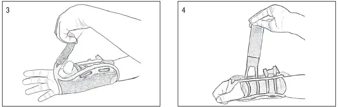 Hely-Weber-450TINY -Tiny-Titan-Pediatric-Wrist-Splints-fig-2