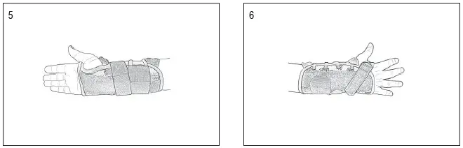 Hely-Weber-450TINY -Tiny-Titan-Pediatric-Wrist-Splints-fig-3