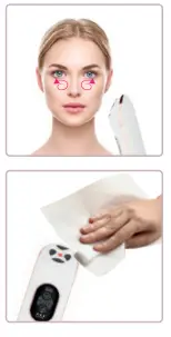 BEAUTIFLY-Pro-Series-Rejuvenation-Radio-Frequency-FIG-4