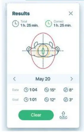 Smart Solutions IBACK1 Posture Corrector - correct posture