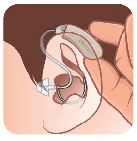 otofonix Encore Hearing Aid Hearing Amplifier for Ear-Tips