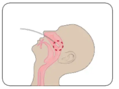 Attogene AU2033 SARS-CoV-2+InfluenzaA and BAntigen Assay - fg 4