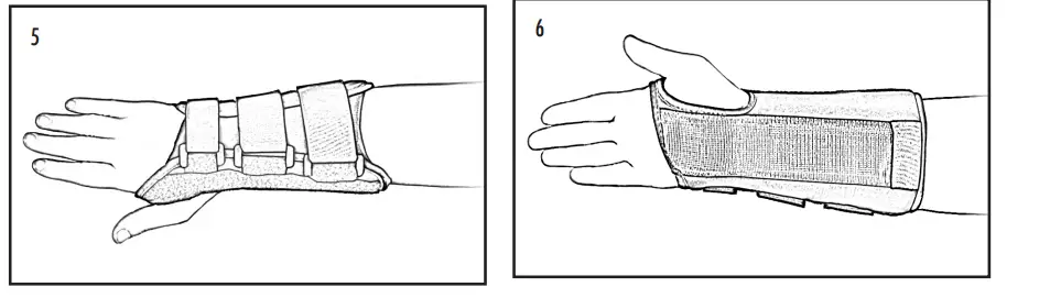 HELY-WEBER-Phomfit™-Wrist-Orthosis-FIG-3