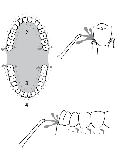DentJet-DJ-159-Water-Flosser-Cordless-Portable-Oral-Irrigator-7