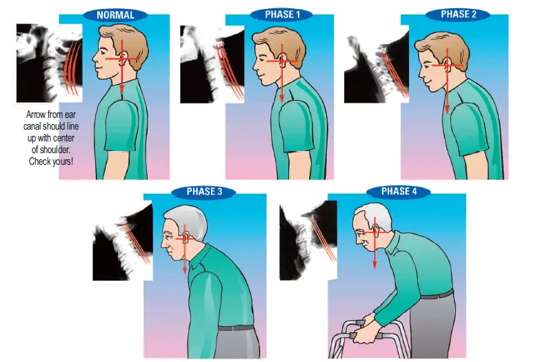 Posture-Pump-Disc-Hydrator-Instructions-FIG-1