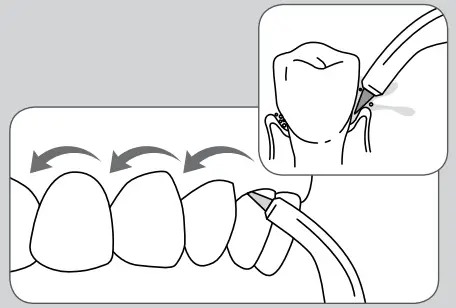 waterpik Water Flosser WP-320 Series - figure 7