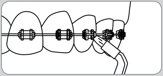 waterpik Water Flosser WP-320 Series - figure 9