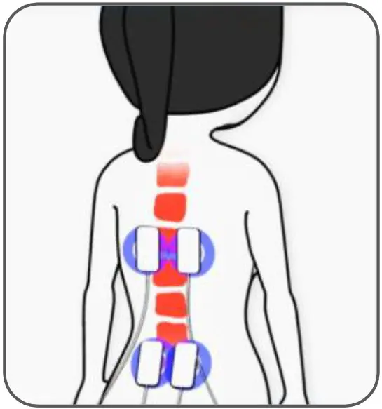 TensCare Tens One Dual Channel TENS Pain Relief - HOW “TENS” WORKS