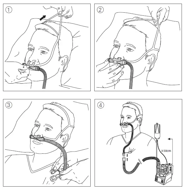 ResMed-HFNC-AcuCare-High-Flow-Nasal-Cannula-1