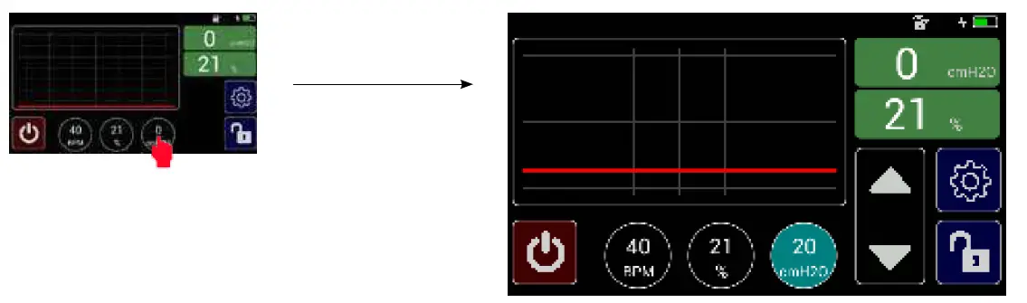 MTTS-Beluga-V1-Resuscitator-04