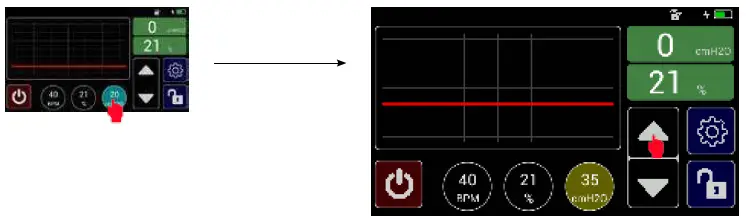 MTTS-Beluga-V1-Resuscitator-05